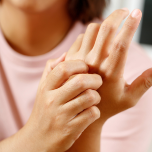 Mild eczema on hands as a woman in a pink top scratches her irritated skin